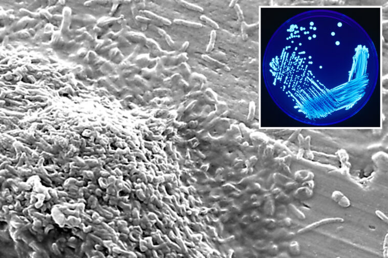 cluster-of-legionnaire’s-disease-cases-found-in-nyc-as-health-officials-on-alert