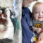 world’s-most-premature-baby-defies-all-medical-odds-to-reach-1st-birthday