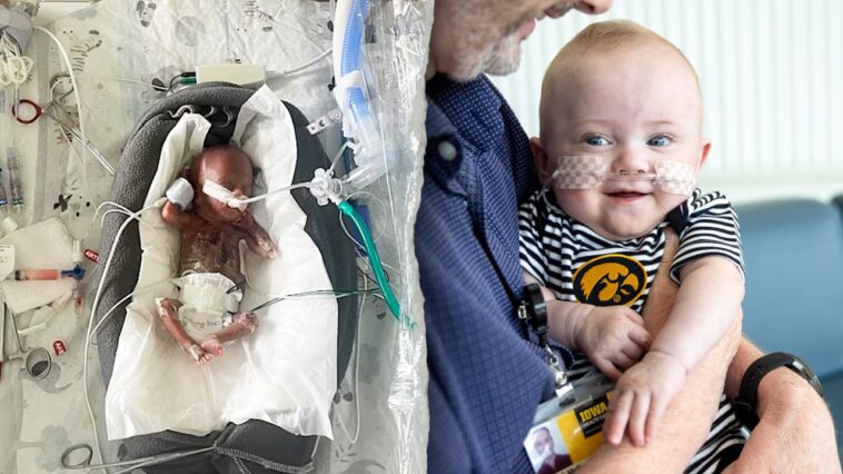 world’s-most-premature-baby-defies-all-medical-odds-to-reach-1st-birthday