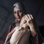 report:-gaza-child-in-widely-used-photo-of-‘starvation’-has-muscular-disorder