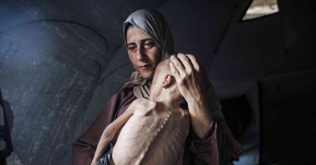 report:-gaza-child-in-widely-used-photo-of-‘starvation’-has-muscular-disorder