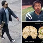 what-is-cte?-the-neurodegenerative-disease-nyc-gunman-shane-tamura-claimed-to-have