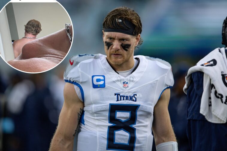 titans-qb-will-levis-shares-gruesome-photo-of-shoulder-before-surgery