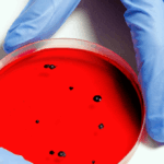 video:-nyc-health-officials-warn-of-legionnaire’s-disease-outbreak