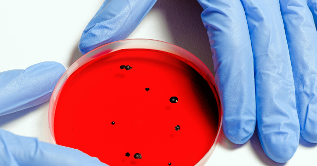 video:-nyc-health-officials-warn-of-legionnaire’s-disease-outbreak