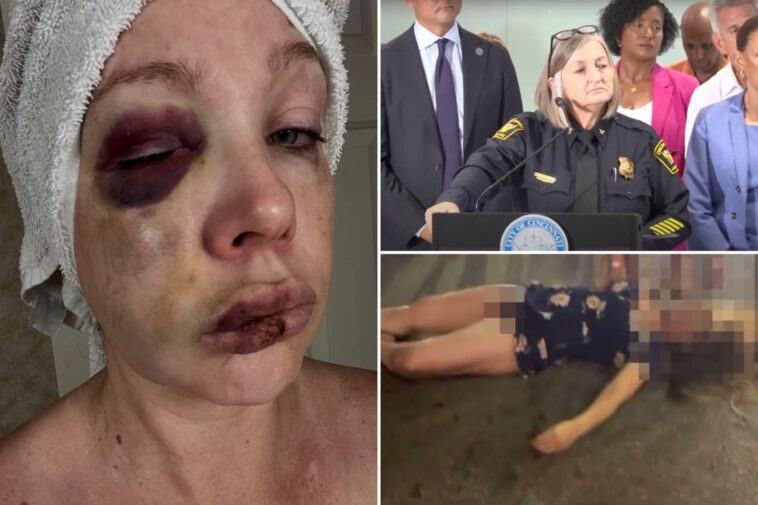 cincinnati-police-chief-vows-to-release-more-footage-of-viral-brawl-that-left-woman-knocked-out-cold