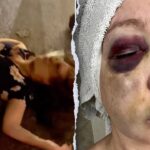 cincinnati-beatdown-victim-reveals-‘very-bad-brain-trauma’-in-first-remarks-since-viral-assault