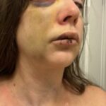 cincinnati-mob-violence-victim-holly-breaks-her-silence,-reveals-she-is-suffering-“very-bad”-brain-trauma-(video)