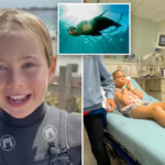 9-year-old-girl-bitten-by-sea-lion-in-rare-attack-while-at-surf-camp:-‘i-was-like,-oh-my-gosh-…-and-it-just-bit-me’
