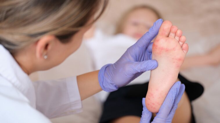 highly-contagious-disease-surges-in-some-us-states-amid-report-of-possible-fatal-case