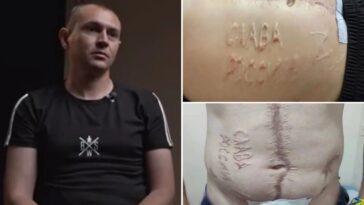 tortured-ukrainian-pow-branded-with-‘glory-to-russia’-vows-to-return-to-battle-after-recovery:-‘thirst-for-revenge’