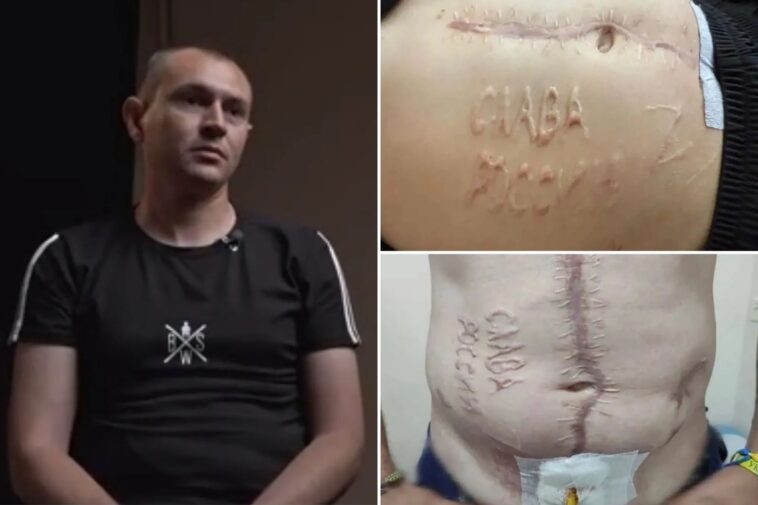 tortured-ukrainian-pow-branded-with-‘glory-to-russia’-vows-to-return-to-battle-after-recovery:-‘thirst-for-revenge’