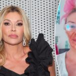 brandi-glanville-suffers-severe-chemical-burns-on-her-face-while-trying-to-self-treat-mystery-illness
