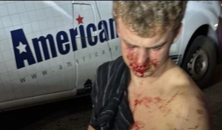 police-report-reveals-heroic-actions-taken-by-edward-coristine,-aka-“big-balls”-to-defend-his-girlfriend-from-dc-thugs-during-attempted-carjacking