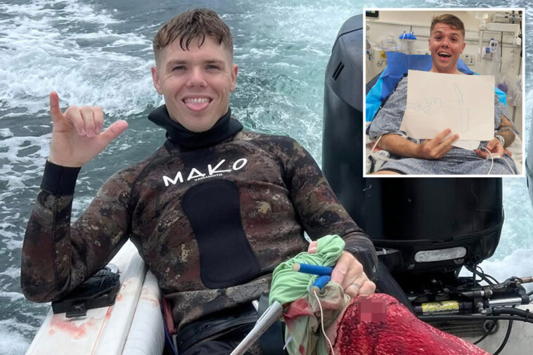 incredible-photo-shows-fisherman-smiling-while-covered-in-blood-from-‘gnarly’-shark-attack