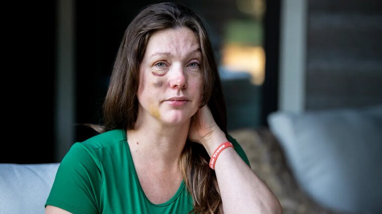 cincinnati-viral-beating-victim-says-violent-mob-started-attacking-‘like-a-pack-of-wolves’