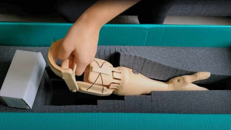 affordable-3d-printed-bionic-arm-uses-muscle-signals-to-move
