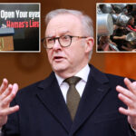 australia-will-recognize-a-palestinian-state,-prime-minister-albanese-says