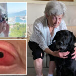 elderly-blind-woman-regains-sight-thanks-to-rare-surgery-that-implants-tooth-into-eye-socket