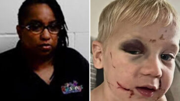 daycare-worker-arrested-for-child-abuse-as-toddler-left-with-black-eye-and-swollen-face-on-first-day-at-church-run-center
