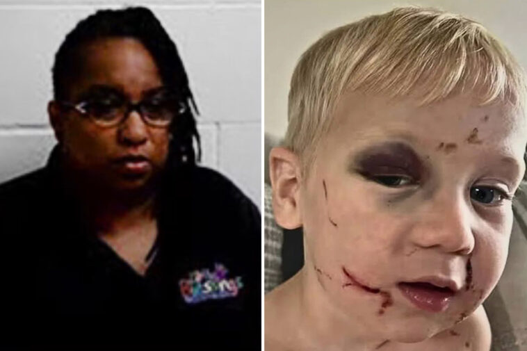 daycare-worker-arrested-for-child-abuse-as-toddler-left-with-black-eye-and-swollen-face-on-first-day-at-church-run-center
