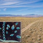 ‘valley-fever’-has-spiked-1,200%-in-california-—-why-more-people-are-getting-the-disease-that-can-spread-to-their-bones-and-brain