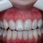 video-—-police:-florida-woman-posing-as-veneer-tech-used-‘crazy-glue’-on-clients’-teeth