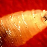 flesh-eating-parasite-case-detected-in-us-traveler-returning-from-central-america