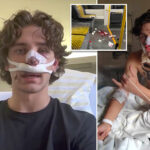 hero-american-tourist-and-model-reveals-extent-of-facial-injuries-suffered-while-defending-two-women-in-germany:-‘wear-my-scar-with-pride’
