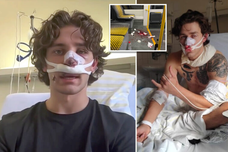 hero-american-tourist-and-model-reveals-extent-of-facial-injuries-suffered-while-defending-two-women-in-germany:-‘wear-my-scar-with-pride’