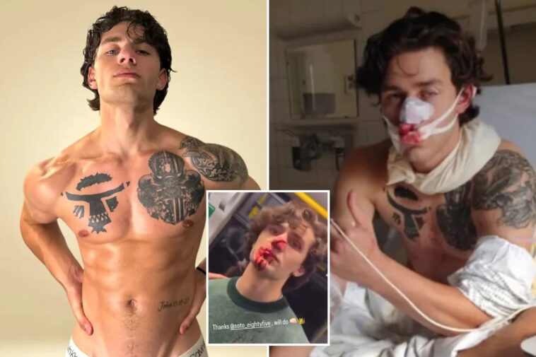 syrian-migrant-accused-of-slashing-hero-american-model-john-rudat-was-previously-let-go-by-cops-before-being-busted-for-gruesome-attack