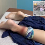 shark-bites-8-year-old-girl-in-grisly-texas-beach-attack:-‘it-was-just-so-much-blood’