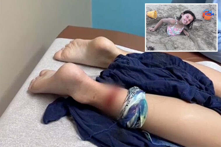 shark-bites-8-year-old-girl-in-grisly-texas-beach-attack:-‘it-was-just-so-much-blood’