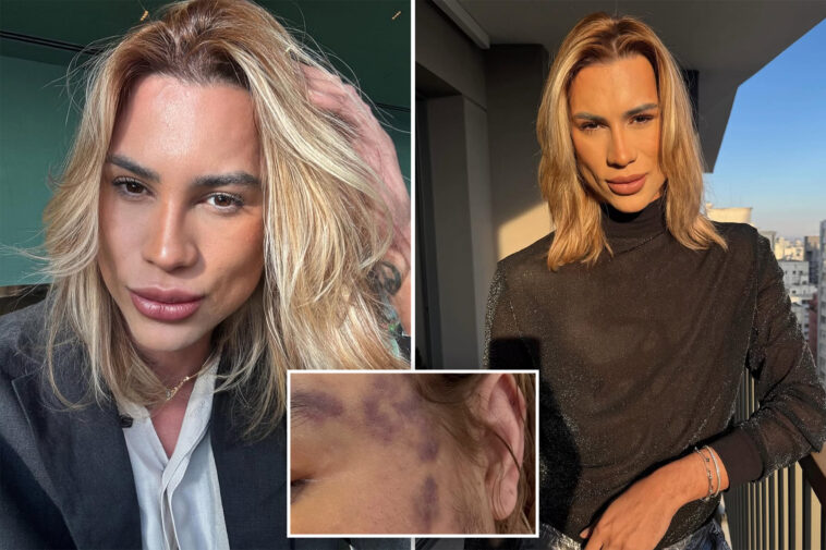 fashion-influencer-dead-after-complaining-about-complications-from-‘fox-eyes’-surgery