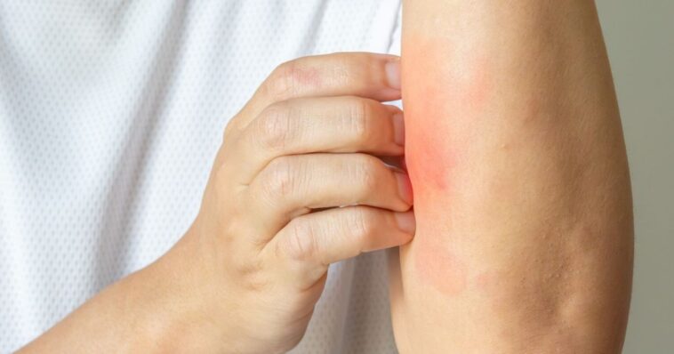 a-promising-new-treatment-for-the-84-million-americans-suffering-from-skin-conditions