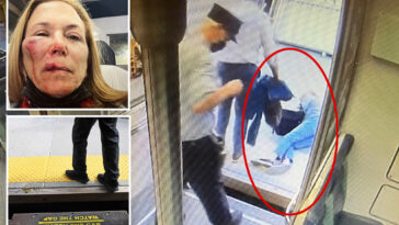 mta’s-faked-safety-checks-at-station-led-to-gruesome-injuries,-platform-mishap:-lawyer