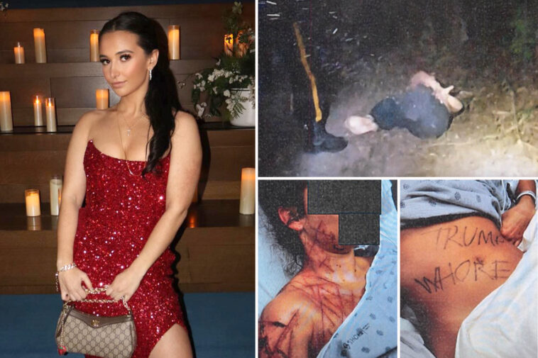 ex-gop-aide-paid-fetish-artist-to-mutilate-her,-claimed-it-was-an-anti-trump-attack:-court-docs