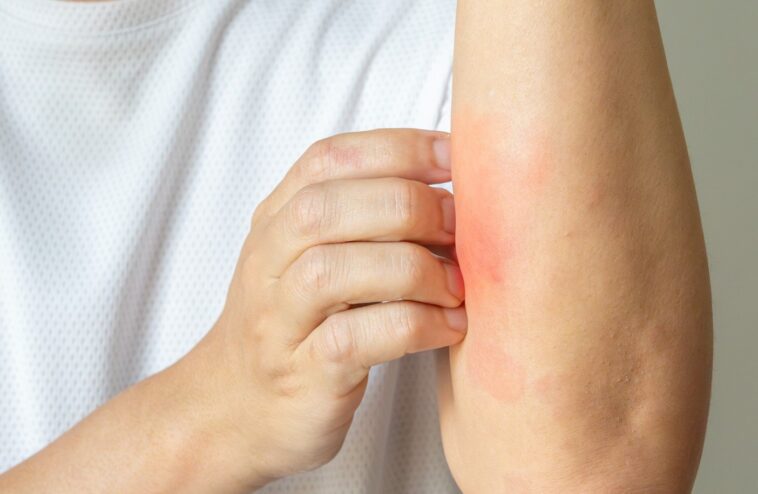 a-promising-new-treatment-for-millions-of-americans-suffering-from-skin-conditions