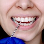researchers-say-human-hair-could-soon-be-key-to-repairing-teeth-damaged-by-cavities