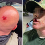 assaults-on-immigration-agents-skyrocket-1,150%-since-trump-took-office-as-sanctuary-city-rhetoric-fuels-disturbing-rise