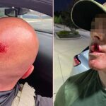 sanctuary-politicians’-rhetoric-led-to-1,150%-surge-in-violence-against-ice-agents:-dhs