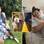 student-tourist-who-lost-arm-and-leg-in-nyc-subway-accident-wins-staggering-$82m-verdict