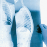 15-year-old-athlete-walks-out-of-california-hospital-after-paralyzing-spinal-injury