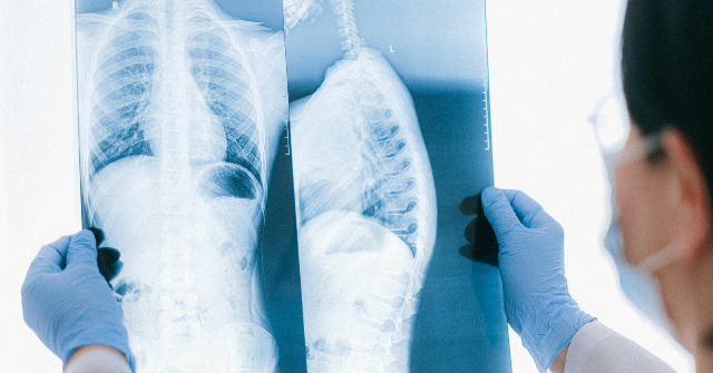 15-year-old-athlete-walks-out-of-california-hospital-after-paralyzing-spinal-injury