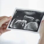 scotland-may-soon-allow-abortions-up-to-birth-for-‘social-reasons’