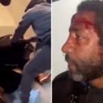 nyc-serial-spitter-bloodied-in-street-style-justice-during-epic-beatdown:-‘worse-than-jail’