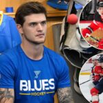 blues’-alexey-toropchenko-burns-legs-during-home-accident-in-nhl’s-latest-bizarre-off-ice-injury