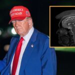 mri-confirms-president-donald-trump-has-incurable-advanced-stage-patriotism