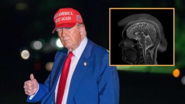 mri-confirms-president-donald-trump-has-incurable-advanced-stage-patriotism