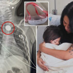 mom-shares-chilling-warning-about-christmas-gifts-after-child-is-hospitalized-for-swallowing-battery